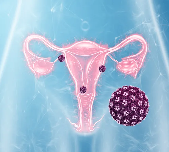 Spontánne HPV clearance